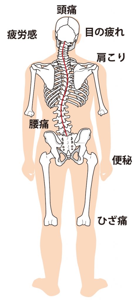 背骨と骨盤の歪み