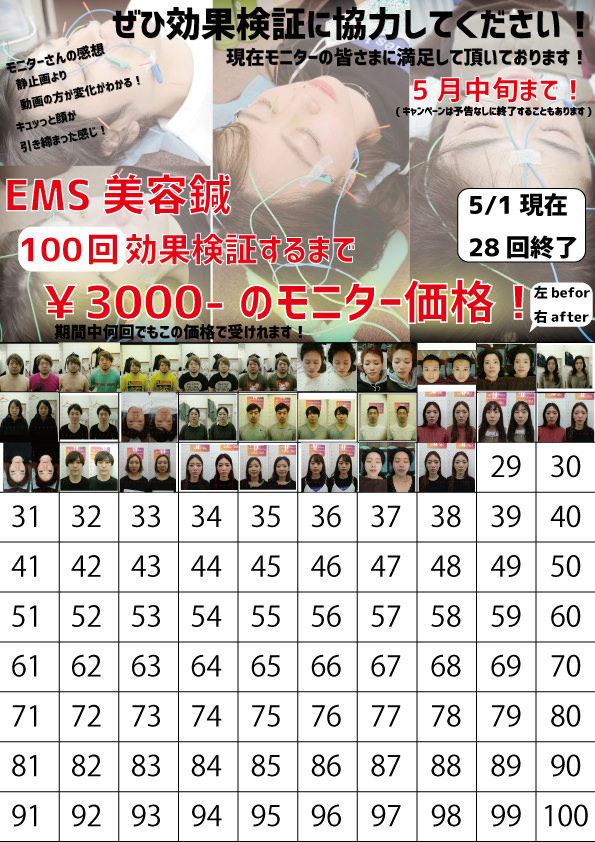 EMS美容鍼100回検証5月
